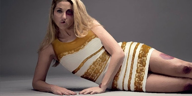 Homepage article image